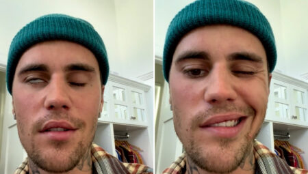 Justin Bieber, Çehre felci hastalığıyla ilgili nihayet durumunu paylaştı